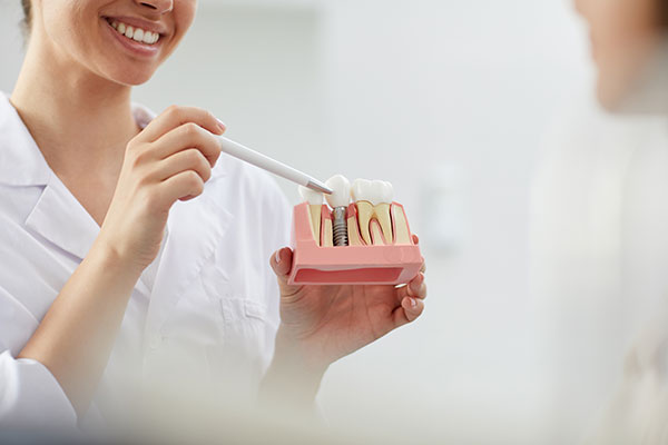 dental-implant